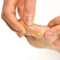 Plantar Wart vs Corn: Understand the Difference and Get the Right Diagnosis Fast