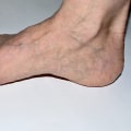 Causes of Bunions: Understanding Foot Pain and Seeking the Right Podiatrist in Los Angeles