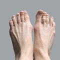 Foot Pain or Genetics? Causes of Claw Toe Deformity Uncovered