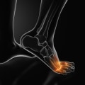 Understanding Podiatry: Symptoms and Treatment Options for Foot Pain Relief in Los Angeles
