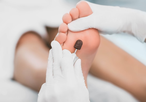 The Importance of Experience in Podiatry: A Comprehensive Guide