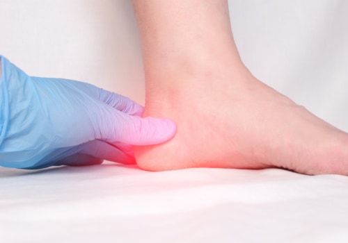 Understanding Plantar Fasciitis: Causes, Symptoms, and Treatment Options