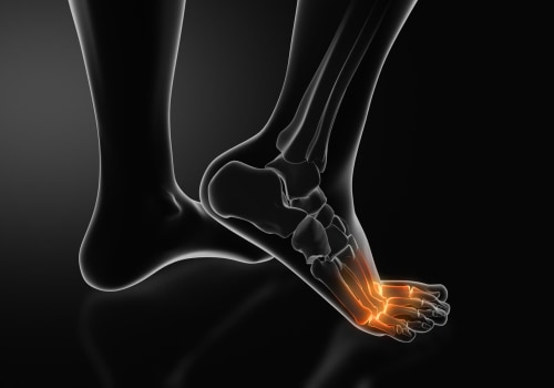 Understanding Podiatry: Symptoms and Treatment Options for Foot Pain Relief in Los Angeles